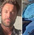 Carro que atropelou Kayky Brito ficou destruído   Foto: Reprodução/Instagram/TV Globo