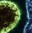 O vírus Nipah isolado em laboratório Crédito  Foto: Reprodução/Instituto Nacional de Alergia e Doenças Infecciosas dos EUA / Perfil Brasil