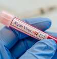 Imagem meramente ilustrativa de uma amostra de sangue infectado pelo Nipah vírus  Foto: Manjurul / iStock