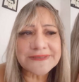 “Um dia acordei e meu olho direito estava verde", revela Simone Ribeiro  Foto: Arquivo Pessoal