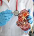 A doença renal crônica consiste em lesão renal e perda progressiva e irreversível da função dos rins  Foto: H_Ko | Shutterstock / Portal EdiCase
