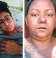 Kelli, Shely e Liliane relatam sofrer de efeitos colaterais pela inserção do Essure.  Foto: Arquivo pessoal / BBC News Brasil