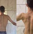 Jovem viraliza ao mostrar recuperação de escoliose grave   Foto: Reprodução Tik Tok