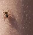 Imagem meramente ilustrativa de uma aranha no corpo de uma pessoa  Foto: gashgeron / iStock