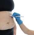 Bariátrica: qual tipo de cirurgia escolher para evitar o reganho de peso? -  Foto: Shutterstock / Saúde em Dia