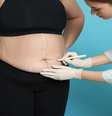 Cirurgia reparadora pós-bariátrica: quando fazer? Médico explica -  Foto: Shutterstock / Saúde em Dia