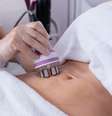 Quatro dicas para eliminar flacidez no corpo - Shutterstock  Foto: Sport Life