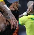 LCA: entenda a lesão do Neymar -  Foto: Reprodução Instagram (@neymarjr) / Saúde em Dia