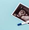 Após fertilização in vitro, mulher deu à luz aos 60 anos; entenda -  Foto: Shutterstock / Saúde em Dia