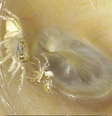 Mulher descobre aranha dentro do ouvido depois de escutar barulhos estranhos  Foto: New England Journal of Medicine