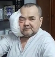 Idoso é internado após tumor facial gigante voltar a crescer   Foto: Divulgação