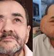 José Nilton Cardozo, de 65 anos, tinha sido internado na segunda-feira, 30, após tumor voltar a crescer.   Foto: Reprodução/Arquivo Pessoal