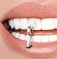 Hábitos que prejudicam os dentes -  Foto: Shutterstock / Saúde em Dia