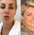 Ana Hickmann e marido, Alexandre Correa. Reprodução/Instagram  Foto: Mais Novela
