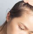 A calvície feminina é uma condição considerada rara -  Foto: Shutterstock / Alto Astral