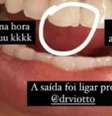 Dente da cantora –  Foto: Reprodução/ Instagram/ @ludmilla / Famosos e Celebridades