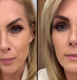 'Todas as verdades que precisam aparecer serão colocadas', diz Ana Hickmann após decisão judicial sobre divórcio.  Foto: Reprodução, Instagram / Purepeople