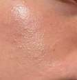 Pele oleosa? Dermatologista explica como deve ser rotina de skincare -  Foto: Shutterstock / Saúde em Dia