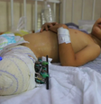 Ahmed Shabat, de 3 anos, perdeu as pernas em uma explosão em Gaza.  Foto: MAHMOUD AKI / BBC News Brasil