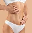 Qual a diferença entre lipoaspiração e lipoescultura? Cirurgião explica -  Foto: Shutterstock / Saúde em Dia