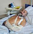 Italiano pode recuperar uso da mão após transplante de nervo de perna amputada  Foto: REUTERS/Massimo Pinca