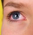  Foto: iStock