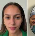 Jovem brasileira troca a cor dos olhos em cirurgia. Saiba os riscos. |  Foto: X/Reprodução / Boa Forma