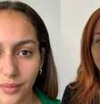 Brasileira viraliza após mudar cor dos olhos: entenda o procedimento  Foto: Reprodução Instagram (@new_color_flaak) / Saúde em Dia