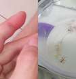 Homem terá dedo amputado após picada de aranha e relata negligência médica  Foto: Arquivo Pessoal/Wilker Guimarães
