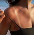 Veja quais são as orientações da dermatologista para cuidar da pele queimada por sol  Foto: Freepik/Divulgação / Boa Forma