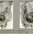 Fotografia de 1908 da dissecação da múmia, mostrando a cabeça do feto ainda dentro da pelve da mãe (Imagem: Margolis, Hunt/International Journal of Osteoarchaeology)  Foto: Canaltech
