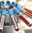 Cientistas desenvolvem exame de sangue capaz de rastrear 18 diferentes tipos de câncer no estágio inicial (Imagem: Maxxyustas/Envato)  Foto: Canaltech