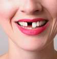  Foto: iStock