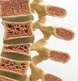 Osteoporose pode atingir a coluna: conheça os sinais e como tratar  Foto: Shutterstock / Saúde em Dia