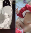 Imagens foram cedidas pelo médico responsável pelo caso, o urologista-pediátrico Hélio Buson  Foto: 