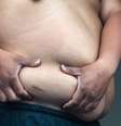10 mudanças que a obesidade causa no corpo e como combatê  Foto: las -  Shutterstock / Saúde em Dia