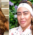 Rafaella Santos faz procedimento de R$ 12 mil e mostra o resultado nas redes sociais  Foto: Reprodução/Instagram