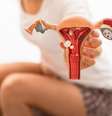 Endometriose afeta mulheres em idade reprodutiva  Foto: Shutterstock / Alto Astral