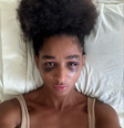 Zuri relatou que está com diversos hematomas e que foi agredida por um grupo de homens  Foto:  Reprodução: Instagram/zurialm/casaraodofirmino