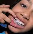 Filha de Kanye West exibe prótese de titânio: quais os riscos dos grillz?  Foto: Reprodução TikTok (@kimandnorth) / Saúde em Dia