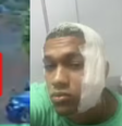 Jovem é agredido com uma garrafa de vidro no rosto após tentar separar briga e leva 37 pontos  Foto: Reprodução/TV Bahia