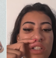 Modelo agredida no DF mostra marcas no rosto  Foto: Reprodução/Instagram @vic_chavess