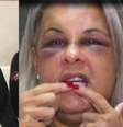 Professor de jiu-jítsu Marcio de Oliveira Barreto, de 54 anos, foi preso suspeito de agredir por horas a ex-companheira   Foto: Reprodução/TV Globo