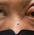  Foto: Reprodução/NEJM