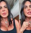 Gretchen explicou novo procedimento que deixou rosto mais 'fino e delicado'  Foto: Reprodução/Instagram