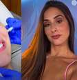 Deniziane realizou harmonização facial após 'BBB 24'.  Foto: Reprodução, Instagram/@anny_ferreira10 / Purepeople