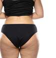 Saiba quais as diferenças entre lipedema e celulite |  Foto: master1305/Freepik / Boa Forma