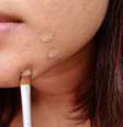 Descubra a técnica para cobrir acne e manchas  Foto: Shutterstock / Alto Astral