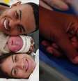 Bebê precisou remover dois dedos por orientação médica  Foto: Reprodução/Instagram