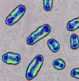 Causada pela bactéria Yersinia pestis, a peste bubônica é tratada atualmente com mais facilidade com os antibióticos modernos  Foto: Getty Images / BBC News Brasil